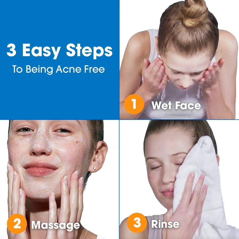 Acne Free Blackhead Removing Exfoliating Face Scrub with 2% Salicylic Acid and Charcoal Jojoba - Daily Wash, Skin Care Face Scrub Acne Treatment For Men Women and Teens With Acne Prone Skin - 5 oz 5 Fl Oz (Pack of 1)