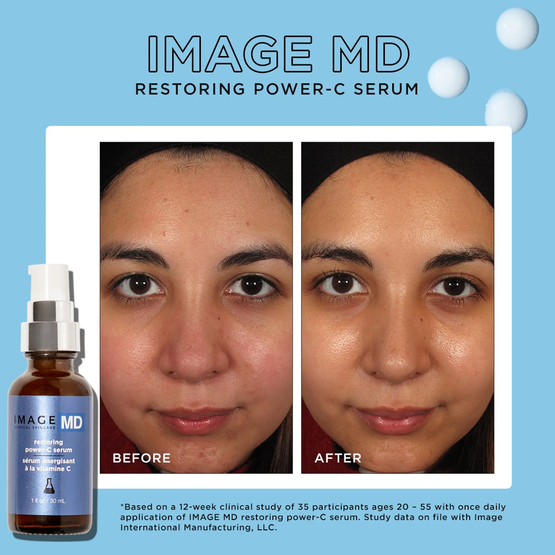 IMAGE MD® restoring power-C serum